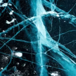 Peripheral Nerve Research